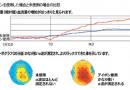 血流向上データー